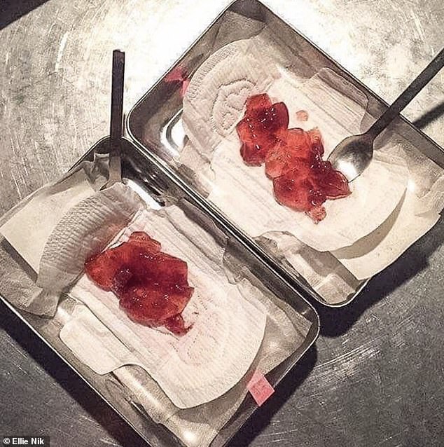 Hilarious Instagram account shares strange ways food has been served to people in restaurants