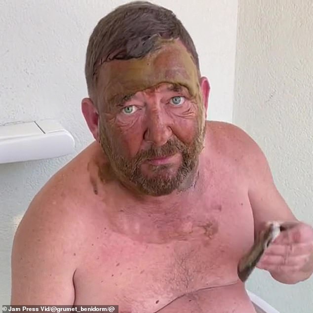 Man suffers hilarious fake tan fail in Benidorm