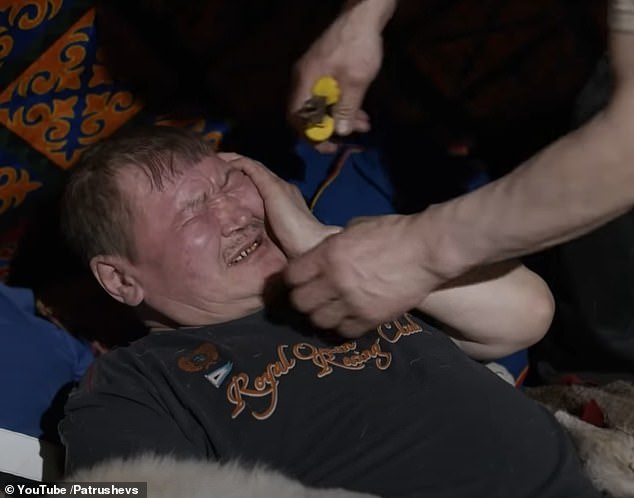 Eye-opening video lays bare the brutal lengths nomadic reindeer herders go to fix their teeth with NO dentist for more than 300 miles – from DIY metal crowns to extractions with PLIERS