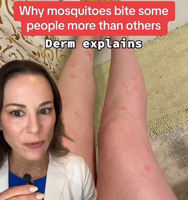 I’m a dermatologist – this is why mosquitoes bite some people more than others