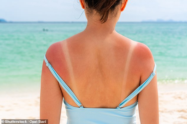 I’m an ER doctor – these are my do’s and don’ts for holiday illnesses and animal attacks, from why you should NEVER put urine on a jellyfish sting to the best ointments for sunburn